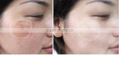 on sales GTO brand new arrival diamond microdermabrasion+hot&cold treatment+ultrasonic 3 functions in one with Factory price