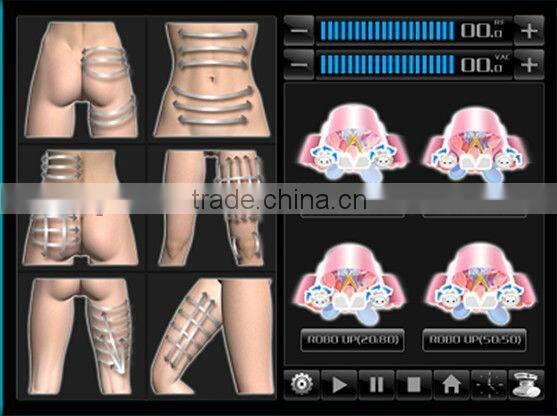 Coolipo V9 Cavitation Machine