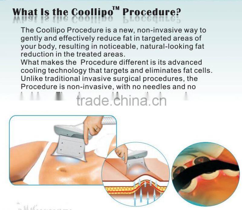 Cryolipolysis/Cryolipolysis Fat Freeze Slimming machine/cryolipolysis weight loss machine