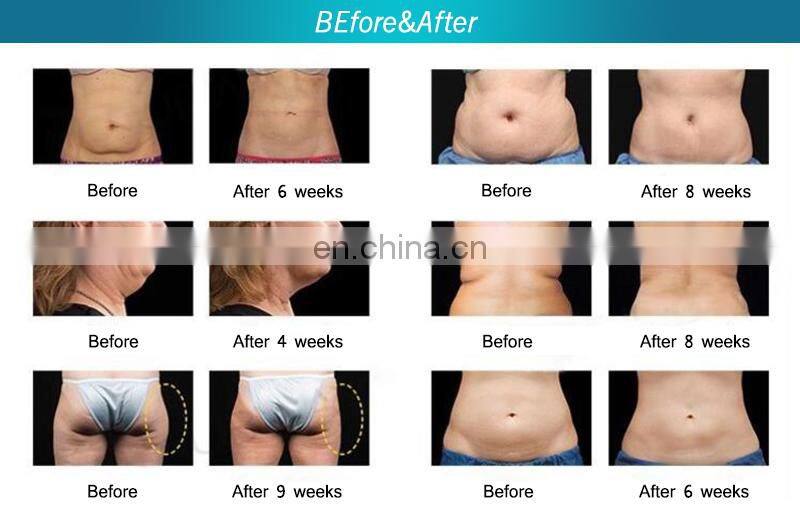 Multifunction high quality shaper V3 vacuum roller rf cavitation infrared body slimming machine