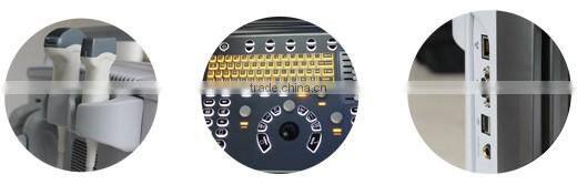 Top quality imaging cheapest BW Chison ECO2 portable ultrasound price