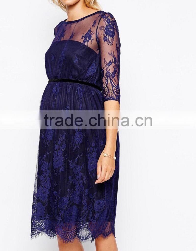 Maternity Lace Midi Dress With Scalloped Detail