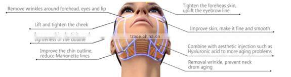 SK-730 Hi-Fu High Intensity Focused Ultrasound