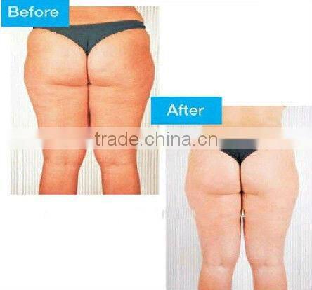 best i lipo laser machine rf vacuum cavitation slimming machine LS650