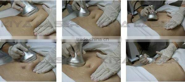 Professional and popular ultrasound machine for pregnancy