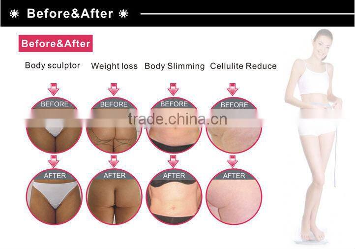 Vacuum Roller Slimming Machine--VelashapeIII