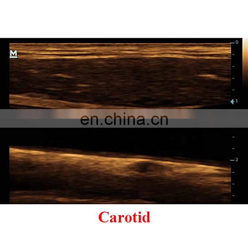 DP-20 Mindray Portable Full Digital Ultrasound Machine Price Mindray Color Ultrasound LED