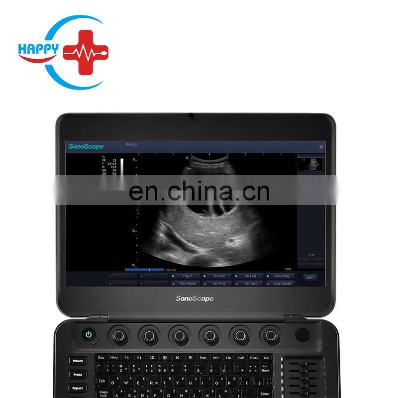 Cheap medical Sonoscape x3 ultrasound machine/Laptop ultrasound scanner/Portable ultrasound probe