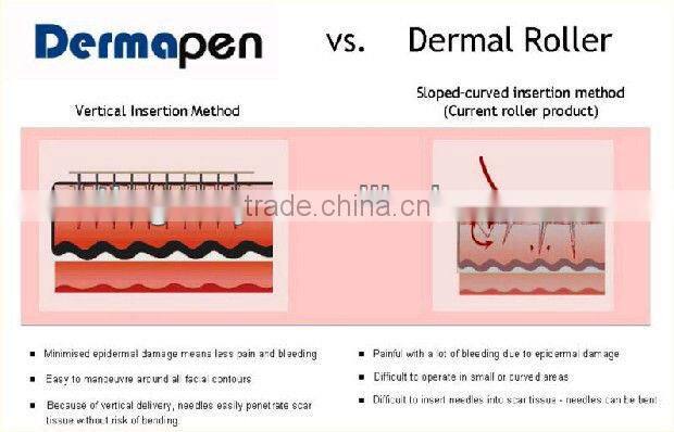 Photon micro needle 540 pins dns derma roller tm-089