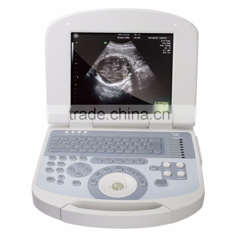 Medical Devices digital Clear Imaging portable ultrasound machine for pregnancy