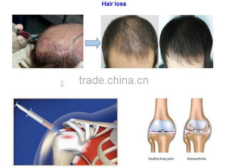 20ml PRP kit Centrifuge for Yes or BS or Dr. PRP kit or Regenlab or Mycell PRP kit