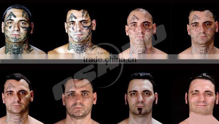 Laser Tatoo Removal Beauty Machine For Full Face Tattoos