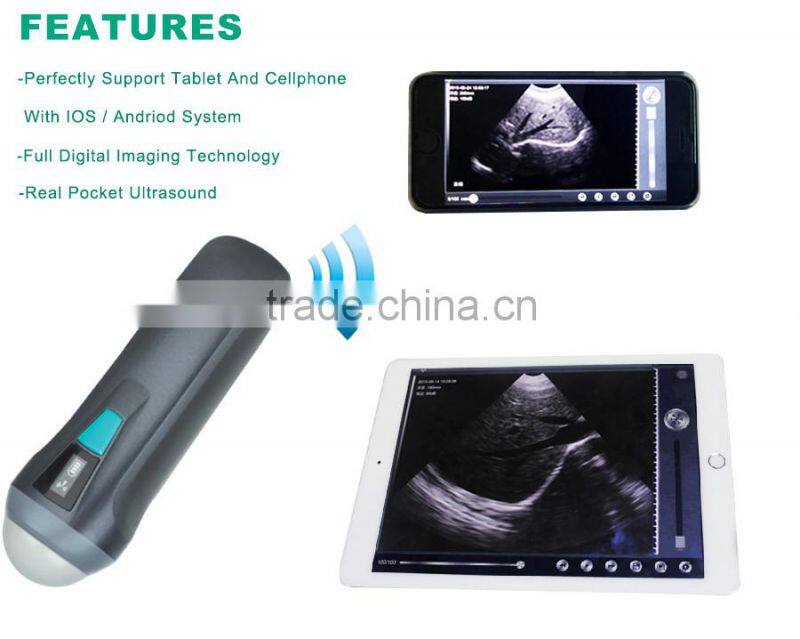 UProbe-1 Wireless Probe Ultrasound Scanner
