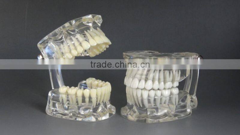 Dental standard transparent dentition model DEA-46