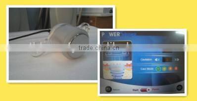 40KHZ weight loss cavitation rf slimming machines