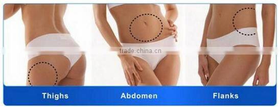 2016 Newest Wight Loss Machine Ultrashape Body Slimming Machine