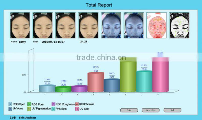 Multi-language magic mirror skin analyzer with CE certificate