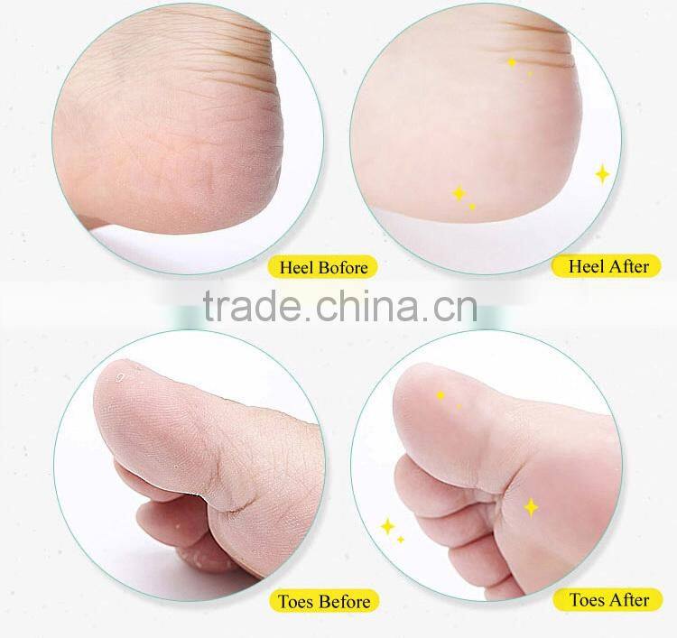 Pedi Foot File Hard Skin Remover Kit Set