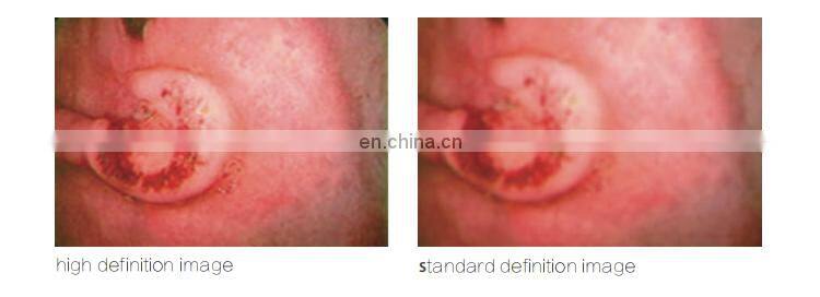 Automatic white balance adjustment LED lamp video endoscopy equipment for veterinary