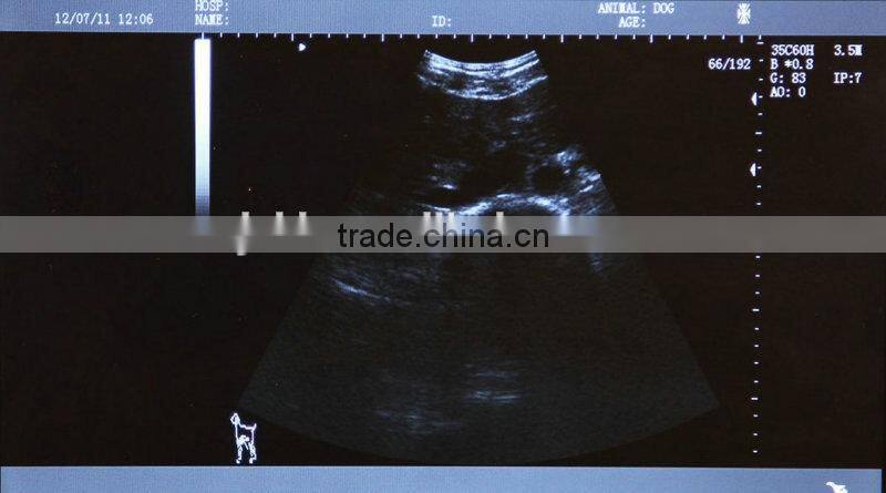 2016 high quality digital Laptop vet Ultrasound Scanner convex linear portable VET Ultrasound machine for sale