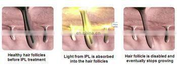 woman hair removal peronal device mini ipl machine