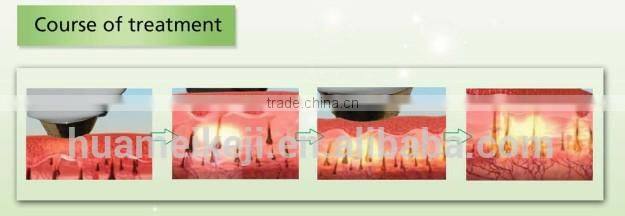 new year promotion 3000w 808nm diode laser / laser diode / diode laser permanent hair removal machine