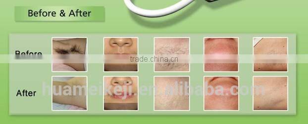 new year promotion 3000w 808nm diode laser / laser diode / diode laser permanent hair removal machine