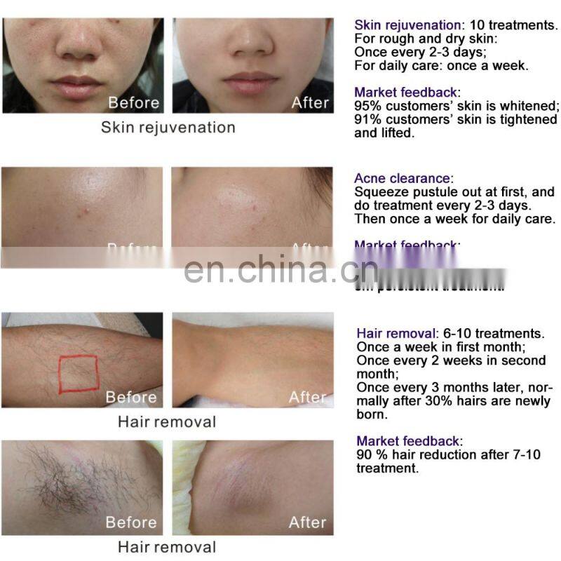 CE Certification full body hair removal & skin rejuvenation &eye care multifunctional home use mini machine