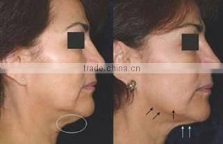 rf radio frequency face lifting radiofrequency equipment