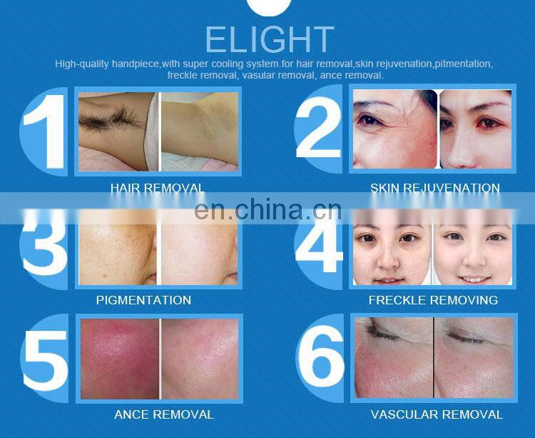 High quality comfortable 2 in 1multifuncional elight underarm whitening 808nm lumenis diode laser hair removal machine