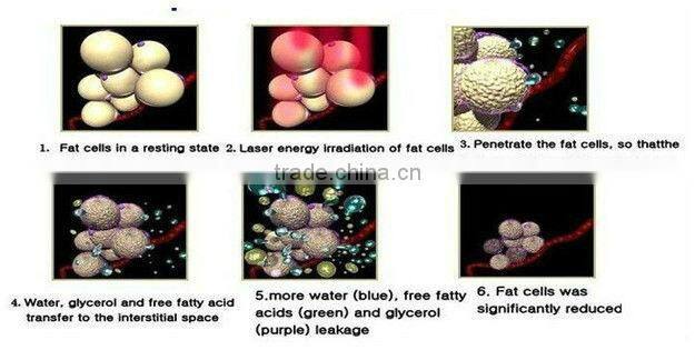 promotion+factory+best quality lipo laser(Amazing fast sliming!!!)