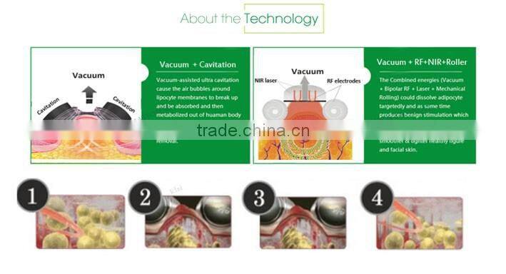 KLSI beauty slim machine/best slimming machine/rf cavitation slimming machine