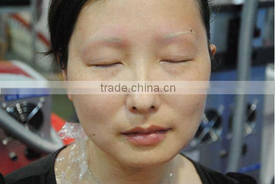 Muti-Function Beauty Equipment IPL SHR Laser