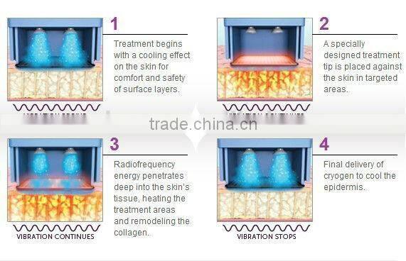 fractional rf microneedle micro needle micro-needle rf machine