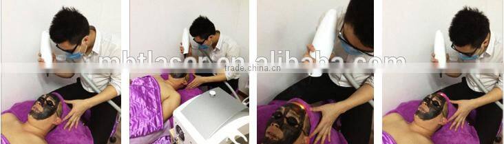 2016 new design nd yag laser cutting machine tattoo removal laser machine with CE and GOST-P