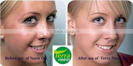 Neem Seed Oil in expoxy coated steel drums