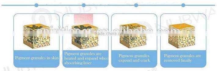 Manufacture tattoo removal machine magnum q switched nd yag laser