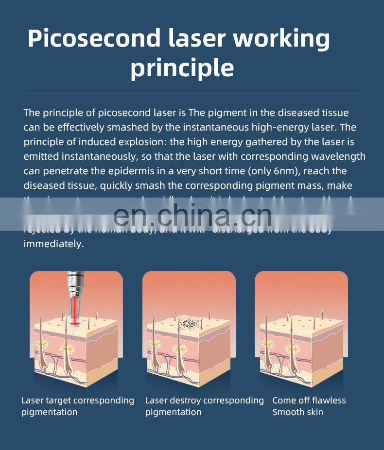 Best profession portable pico second laser eye brow tattoo malasma pigment removal machine