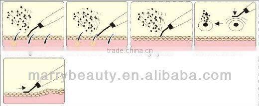 Innovative products for import rechargeable ultrasonic skin scrubber