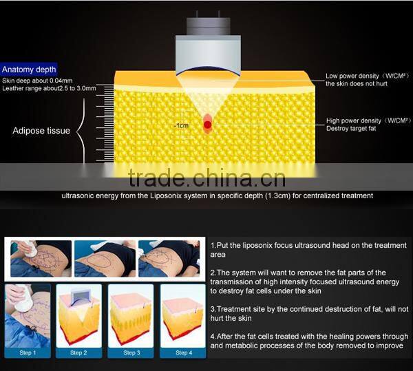 Portable non-surgical liposonix high intesity foucused ultrasound body slimming portable HIFU slimming