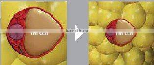 Lipo Cavitation Vacuum Slim Belly