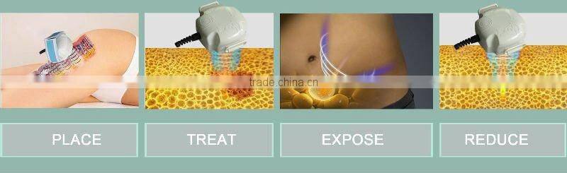 portable home use cavitation with CE