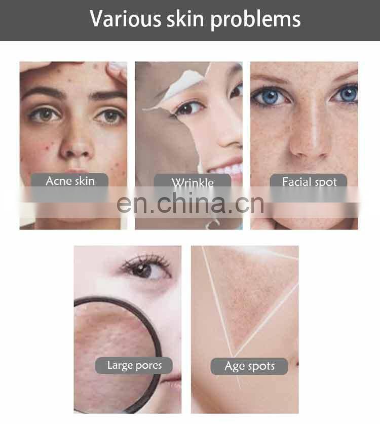 2019 Newest Ozone Plasma 2 In 1 Plasma Pen jett beauty instrument acne treatment ozone plasma pen with good price