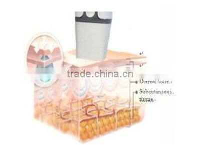fractional RF beauty equipment for skin lifting wrinkle removal