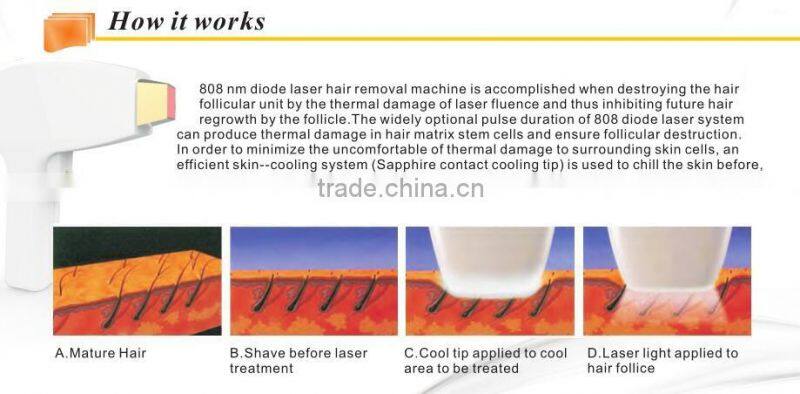 Factory price 808nm Diode Laser Hair Depilation beauty equipment