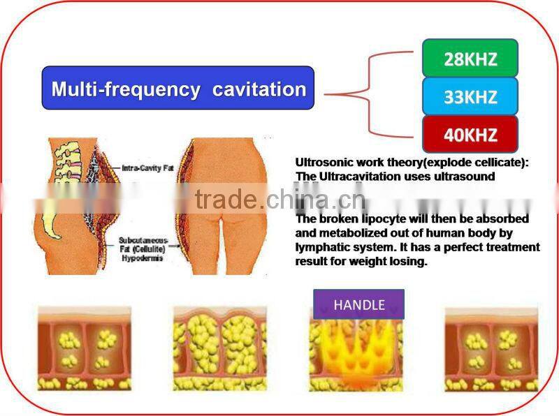 mini ultrasound home use cellulite machine
