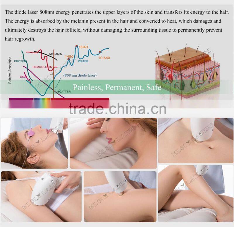 OEM 808 diode laser hair removal machine/depilation/professional hair removal 808