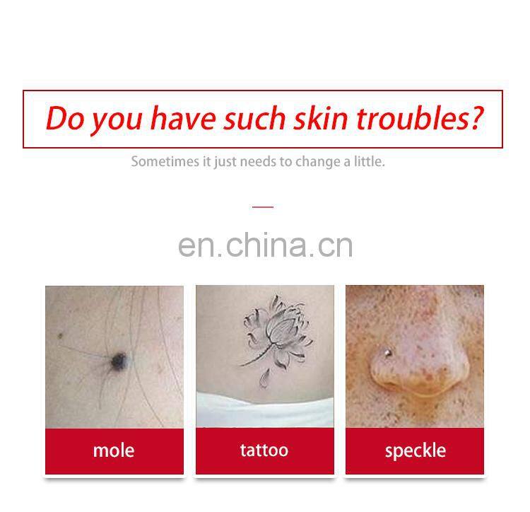 Handhold Skin Care Product Laser Mole Removal Pen Spot Removal Plasma Pen