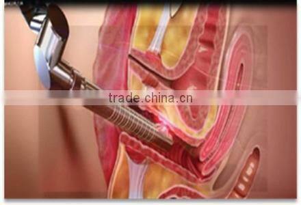 portable thermae portable thermae vaginal tightening China supplier for home use