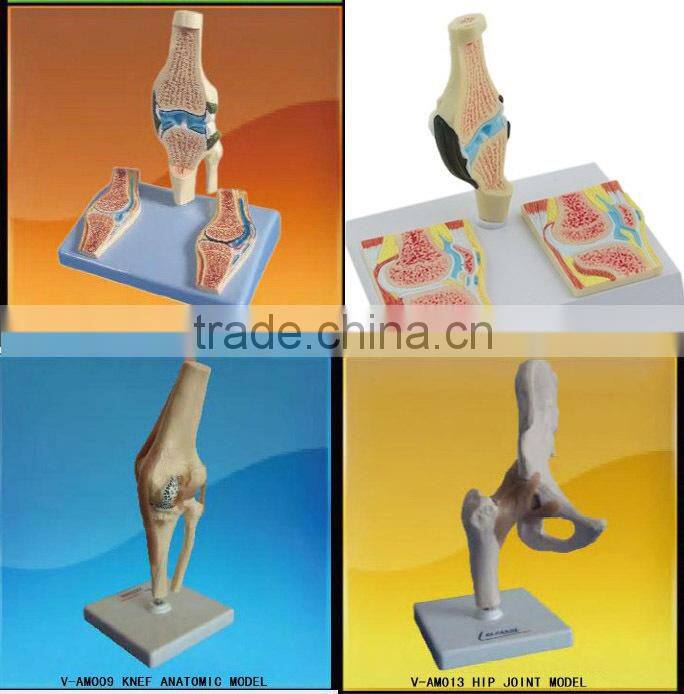 V-AM056 Anatomical Knee Sagittal Model For Medical Teaching